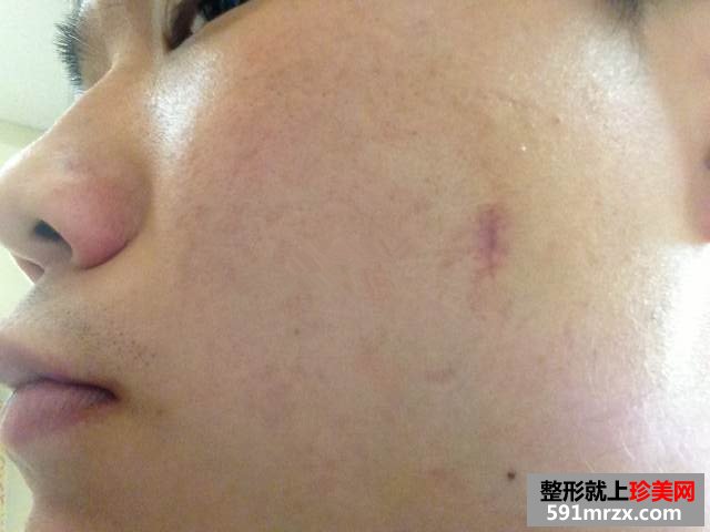 ����ȥ�����Ǯ ����ȥ�밸��