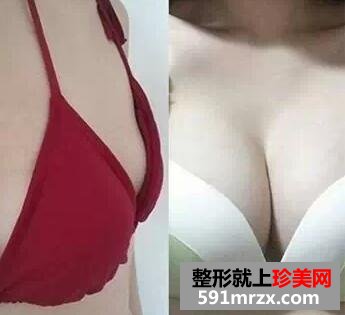 230cc,����,��̬,�ָ�