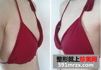 230cc,����,��̬,�ָ�