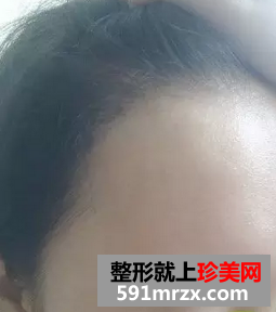 ��ֲͷ��ǰ��Ч��չʾ��ֲͷ����������