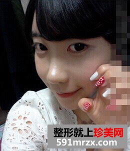 ��̫��Ѩ+�����ǰ��Ч��չʾ