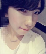 ��̫��Ѩ+�����ǰ��Ч��չʾ