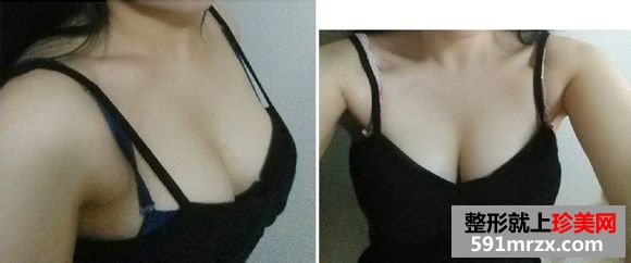 ¡ǰָЧԱͼ